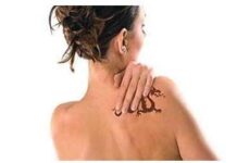 Los tatuajes ya no son para toda la vida