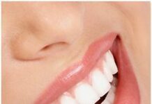 Dientes más Blancos