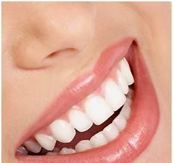 Dientes más Blancos