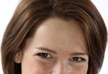 Manchas en la piel, cómo ocultarlas