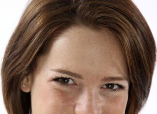 Manchas en la piel, cómo ocultarlas