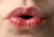 Cuidar los labios en épocas de frío.