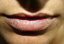 Cómo conseguir labios hidratados todo el año
