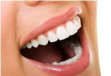 Cómo Conseguir unos Dientes Más Blancos