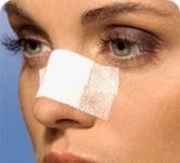 La Rinoplastia y la Autoestima