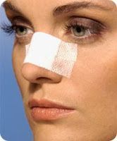 La Rinoplastia y la Autoestima