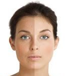 Recetas caseras para aclarar la piel