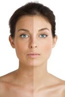 Recetas caseras para aclarar la piel