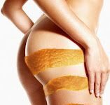 Eliminar la Celulitis. Tratamiento casero