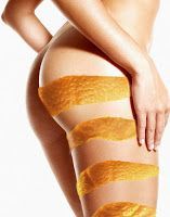 Eliminar la Celulitis. Tratamiento casero