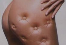 Alimentos para reducir la celulitis