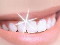 Blanqueamiento dental
