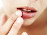 Labios cortados, agrieteados o secos