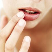 Labios cortados, agrieteados o secos