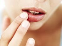 Cómo Quitar la Piel Seca de los Labios