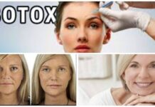 11 VERDADES sorprendentes sobre el BOTOX Cirugia con Botox