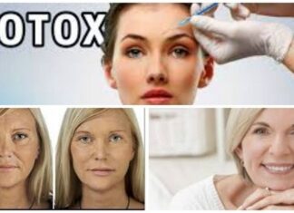 11 VERDADES sorprendentes sobre el BOTOX Cirugia con Botox