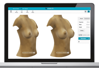 AUMENTO de SENOS con Prótesis: los hechos. Aumento de PECHOS con protesis