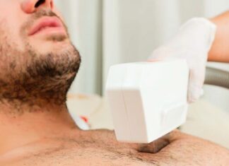 Ventajas de la depilación láser