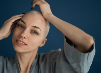 Todo lo que debes saber sobre el trasplante capilar trasplante capilar