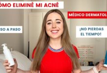 ¿Cómo eliminar y prevenir el acné: Rutina, consejos y productos recomendados?