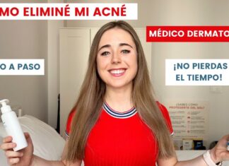 ¿Cómo eliminar y prevenir el acné: Rutina, consejos y productos recomendados?