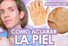 Manchas del sol en la piel 🧴☀️ ¿Qué son los léntigos solares?
